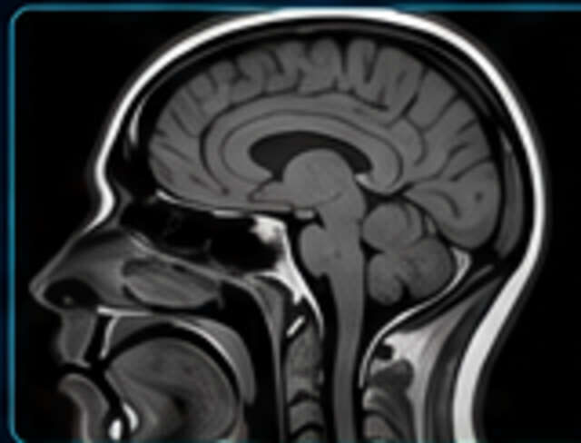 Sagittal brain MRI medical image